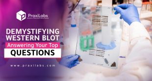 Demystifying Western Blot Test: Answering Your Top Questions