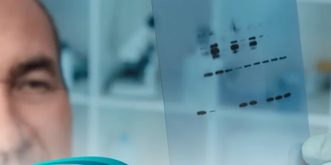 how to analyze western blot data