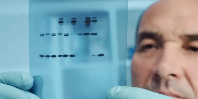 The Concept, Processes, and Applications of Western Blotting