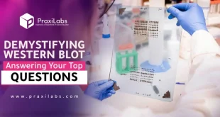 Demystifying Western Blot Test: Answering Your Top Questions