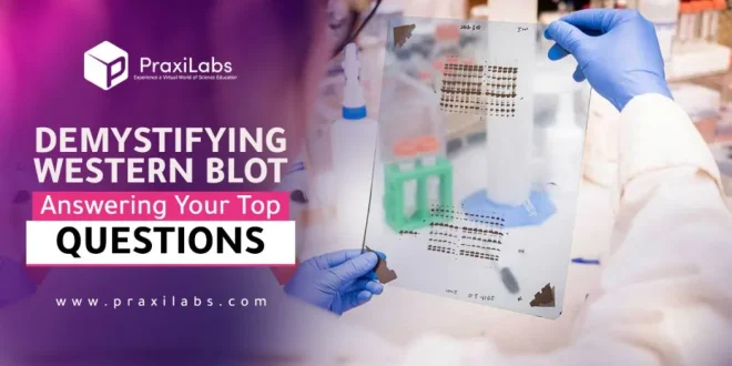 Demystifying Western Blot Test: Answering Your Top Questions