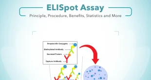 ELISpot Assay | Principle, Procedure, Benefits, and More