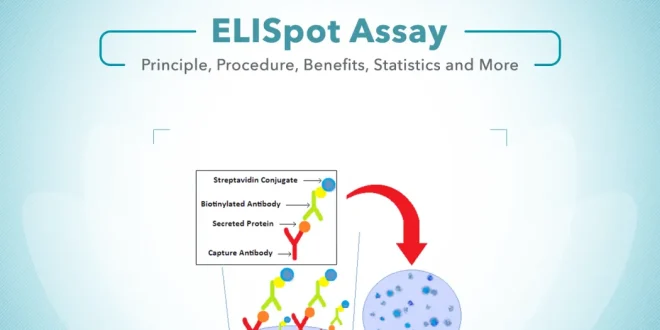 ELISpot Assay | Principle, Procedure, Benefits, and More